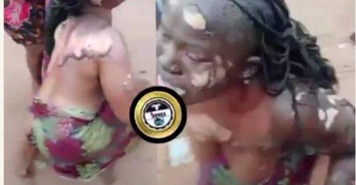 Husband Sets Wife Ablaze In Anambra Over Suspicion Of Infidelity (Graphic)